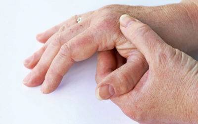 Schüßler Salze und Arthrose – Arthrose erfolgreich behandeln